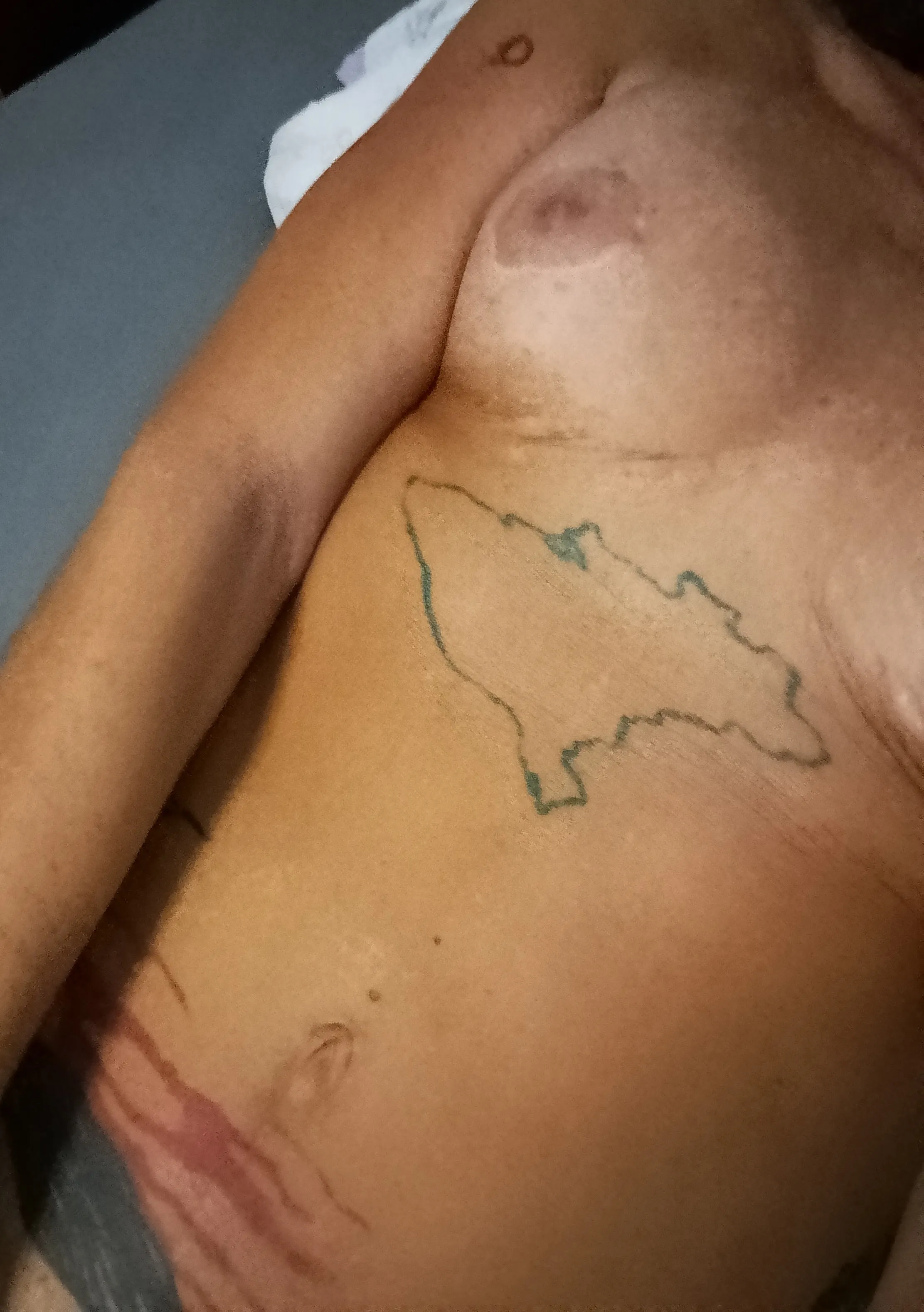 photo-1